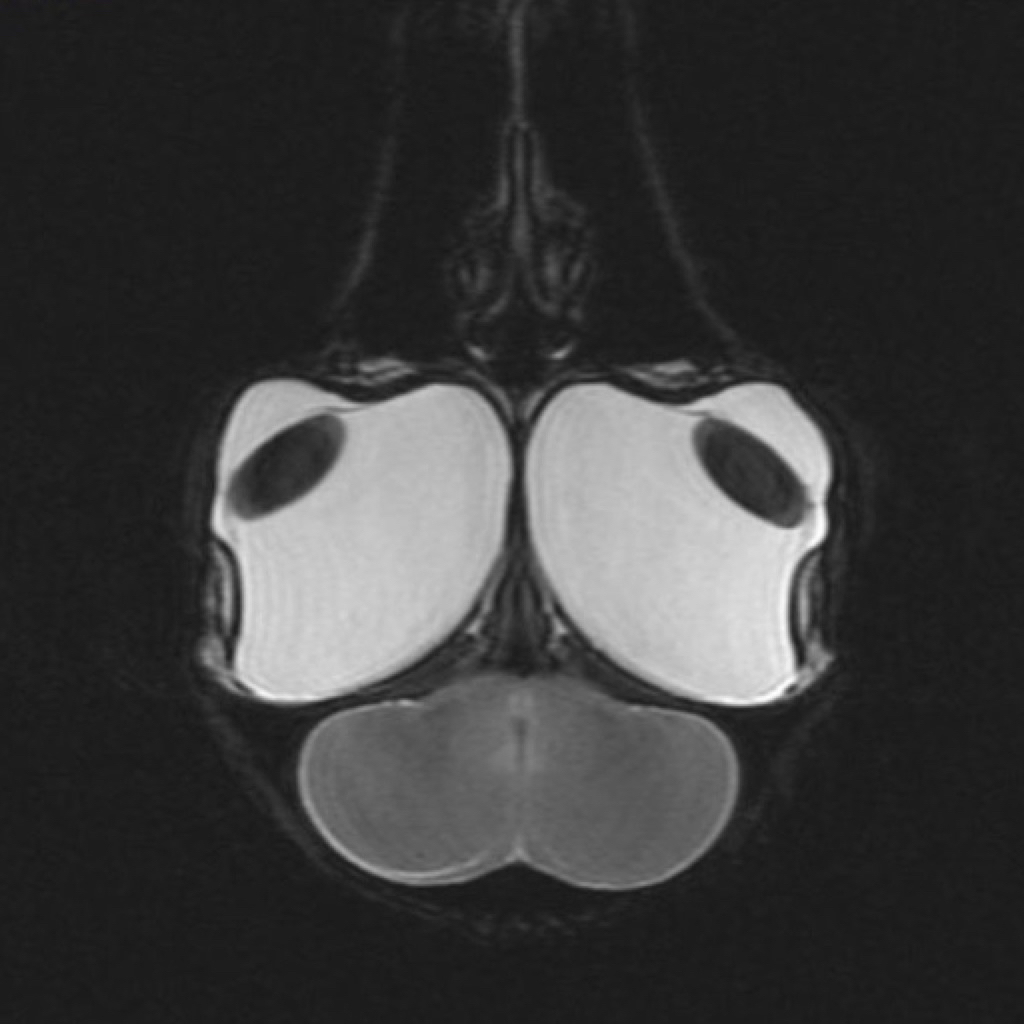 MRI of a Golden Eagle